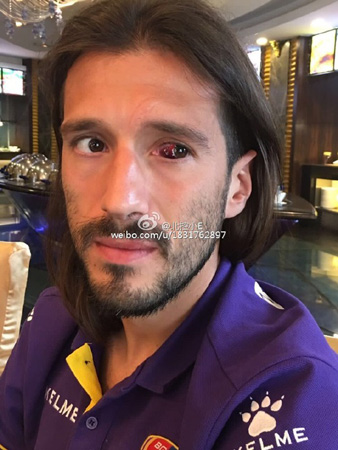 涓敳璧涘満鎯婄幇鏆村姏椋炶腹鐘,涓敳鑱旇禌鐖嗗彂鍐茬獊涓や汉鏌撶孩