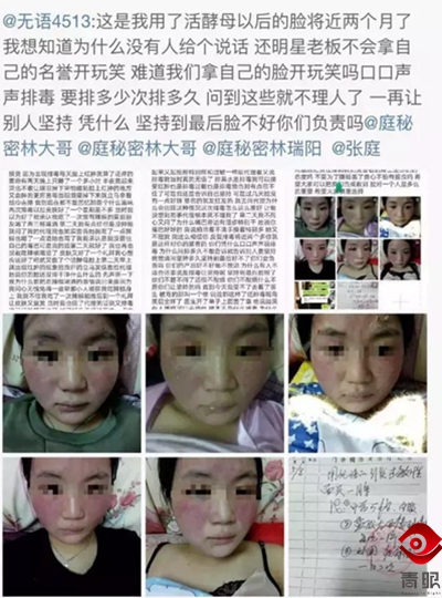 张庭的护肤品毁脸，张馨予、郭德纲自创的就靠谱吗？