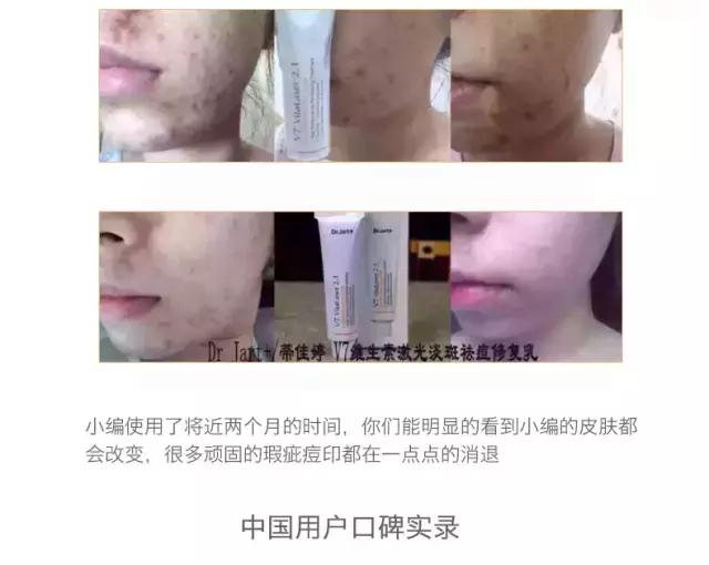 祛痘疤痘印粉刺,Dr.Jart韩国蒂佳婷V7维生素修复霜