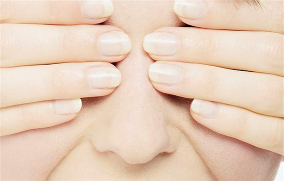 酒糟鼻盯上爱美女孩，5种食疗解决困扰