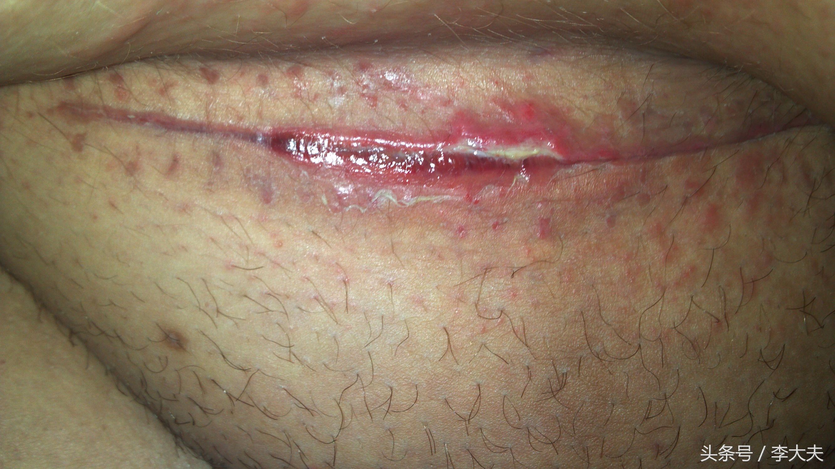 脑洞大开手术,脑洞大开手术后获得超能力