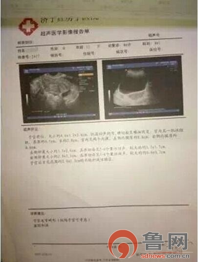 先天性纵隔子宫畸形,女性先天性子宫畸形