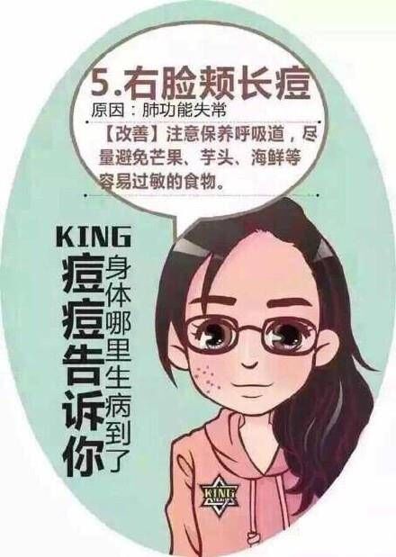 脸上痘痘分布说明身体什么问题,专家讲解痘痘经验