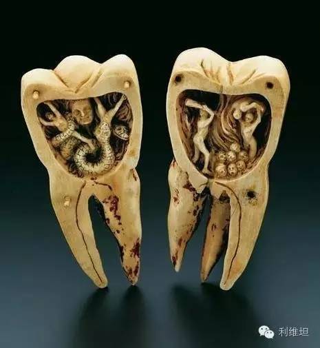 虎口拔牙之后的故事,拔牙放血的故事