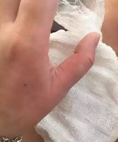 母乳冰敷！美女医生做“直播”引来一群网友围观：长知识了！