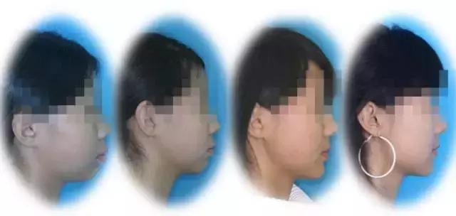 正畸专家介绍图,正畸医生关于整牙的10条建议