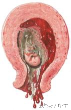 受孕有多困难,受孕困难的女性应该怎么备孕