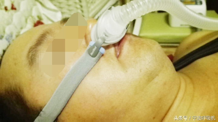 瑞思迈呼吸机面罩,瑞思迈呼吸机s9口鼻面罩