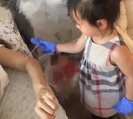 伊能静伤口分析,伊能静谈伤口