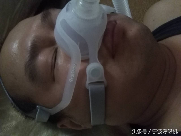 瑞思迈呼吸机s10面罩怎么选,瑞思迈呼吸机n20鼻罩怎么戴才舒服