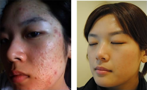 什么品牌的祛皱产品好,什么牌子的祛痘产品效果最好