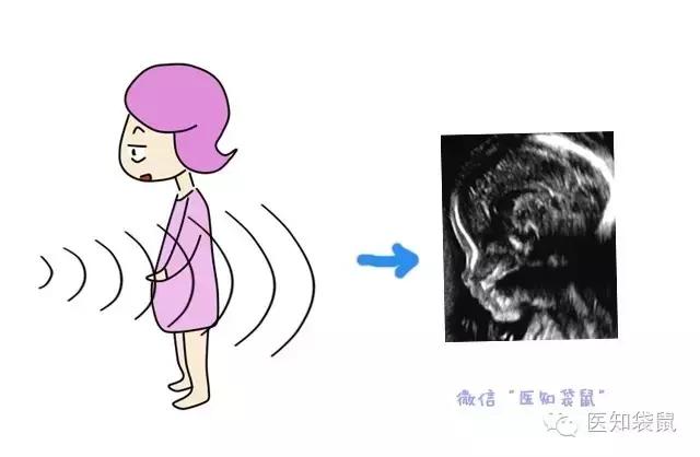 深度解析：普通B超、三维及四维彩超的区别