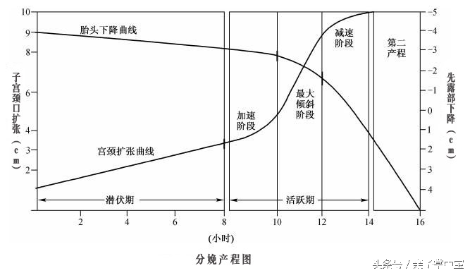 产妇注意了！分娩时生的太快，对新生儿有害！