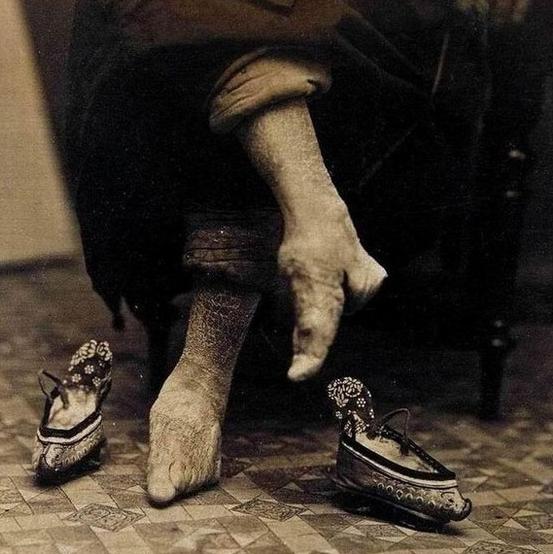 古代女子缠足的真实原因,古代女子缠足的历史真相