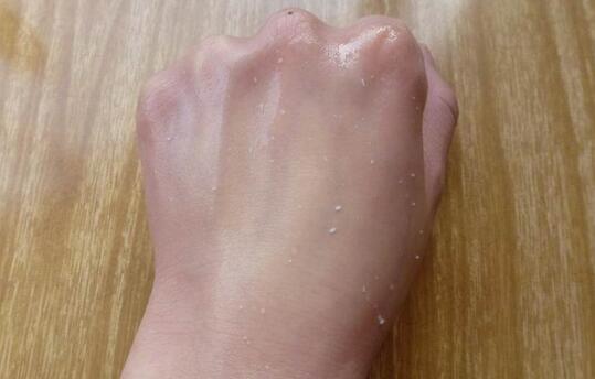 去角质了护肤品还是不吸收,去角质后皮肤过敏怎么解决