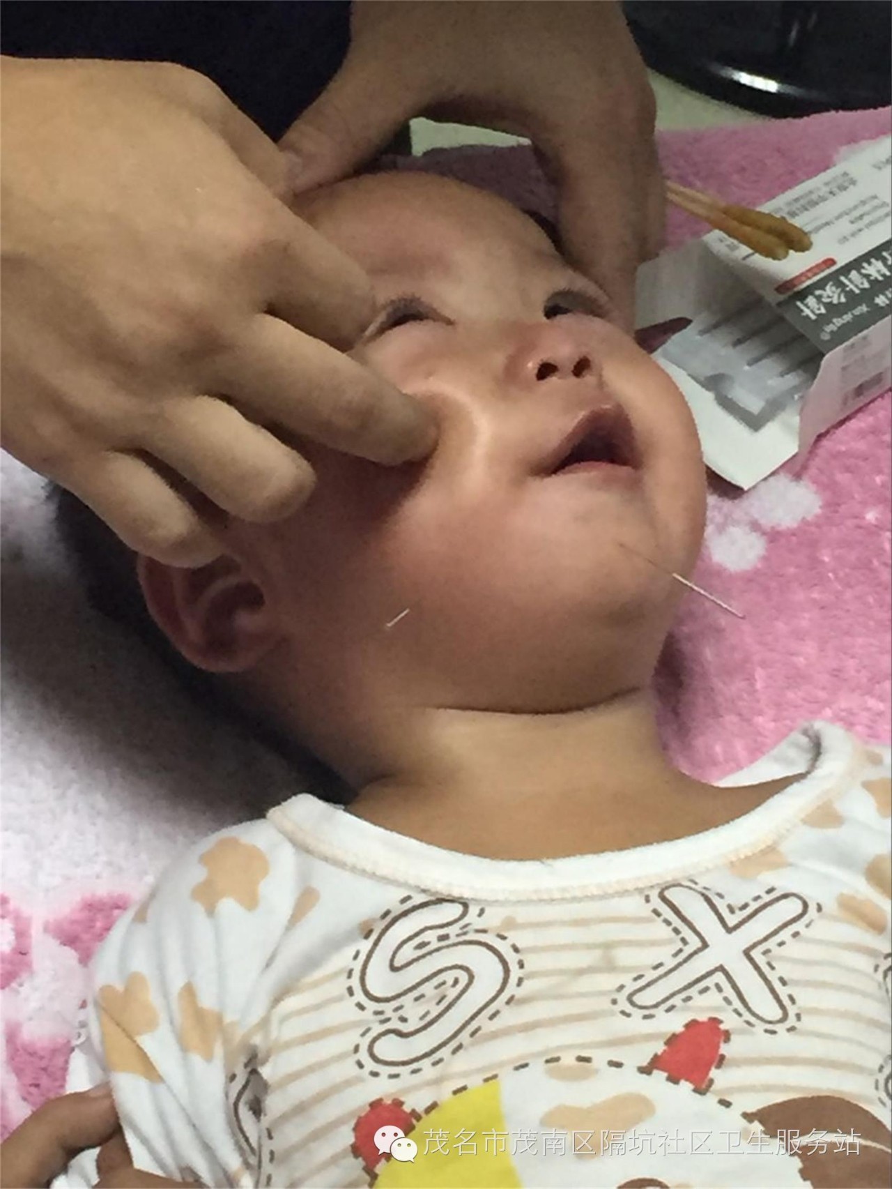 宝宝面瘫有治愈的可能吗,宝宝面瘫