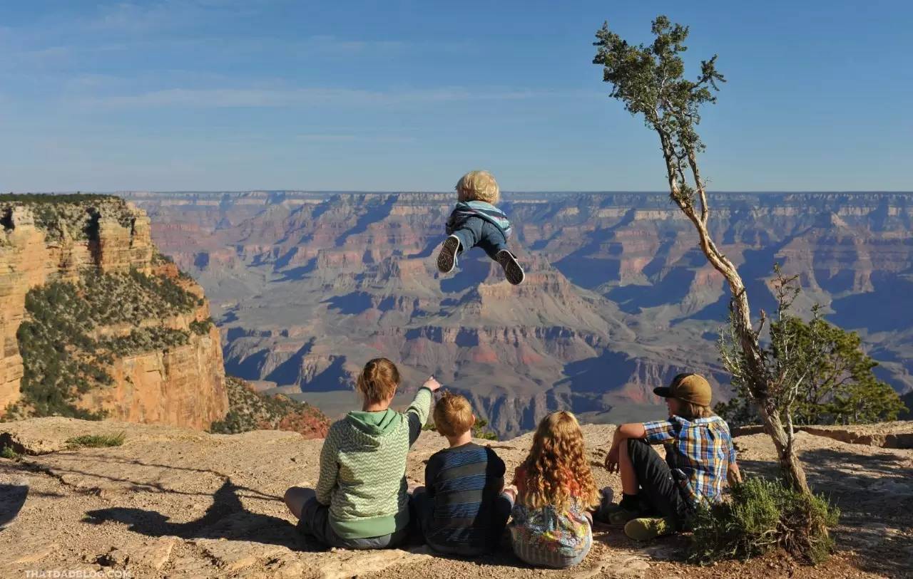 小孩患唐氏综合征,唐氏综合征比较幸运的孩子