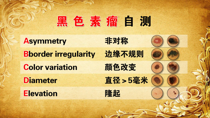 孙红雷黑色素瘤片段,孙红雷黑痣长在什么位置