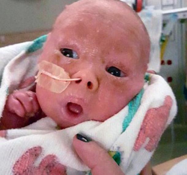 婴幼儿脖子花斑癣多久可以痊愈,婴儿花斑癣怎样算治好了