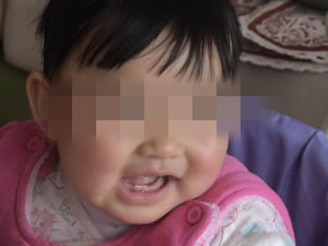 宝宝长牙齿把母乳咬了,宝宝长了四颗牙喂奶老是被咬