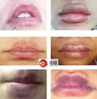 这些坑人的美容项目,那些坑人的神器物品