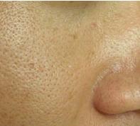 鹿晗护肤技巧,男生美白收缩毛孔妙招