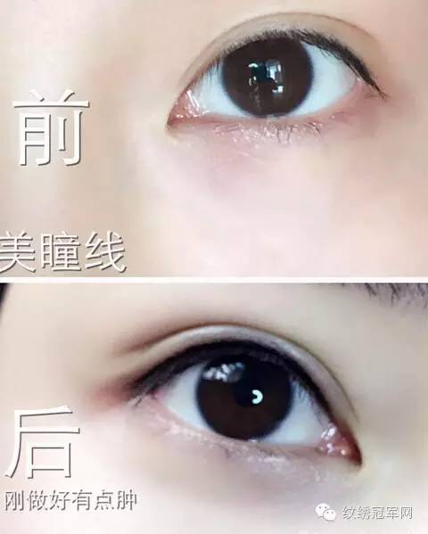 美瞳线太粗,美瞳线太粗了怎么办