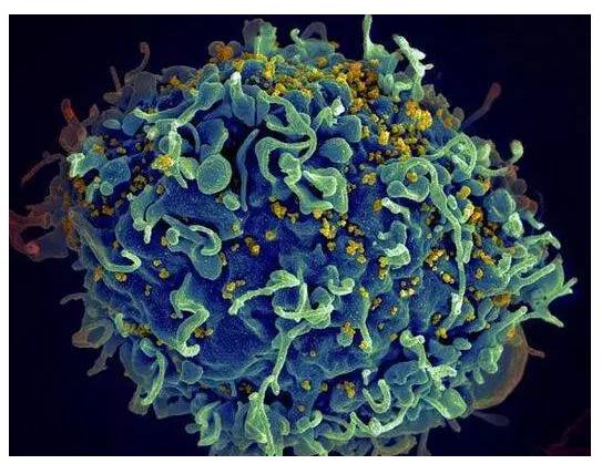 肿瘤治疗新秀,目前肿瘤治疗的新疗法