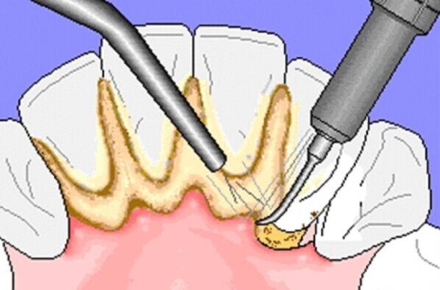 章子怡眼神杀,章子怡吓得宋丹丹尖叫