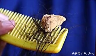 生活小妙招口香糖粘头发上怎么办,口香糖粘到头发上怎么取下来