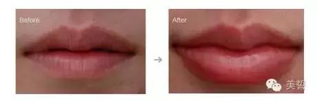 唇唇欲动攻略,唇部拯救你的唇形