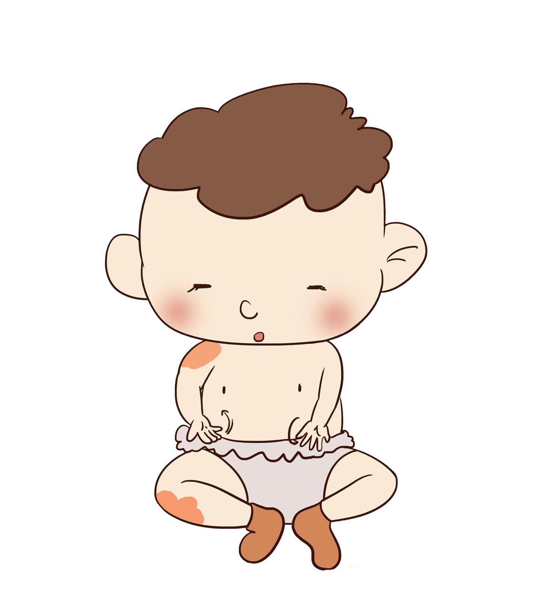 宝宝出现胎记是什么原因,胎记要不要趁早去掉