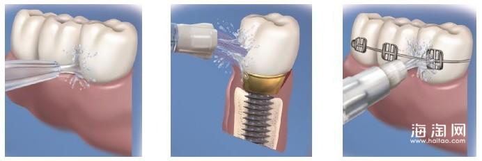 waterpik洁碧冲牙器家用,waterpik洁碧冲牙器门店