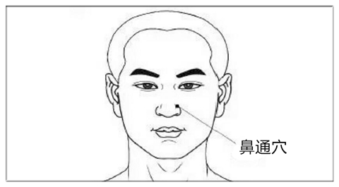 鼻炎鼻塞不通气按摩什么穴位,过敏性鼻炎按摩哪几个穴位最有效