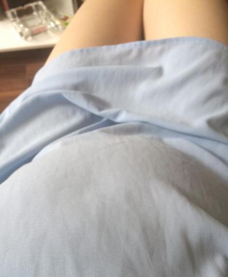 孕中晚期皮肤瘙痒不容小视！警惕妊娠肝内胆汁淤积