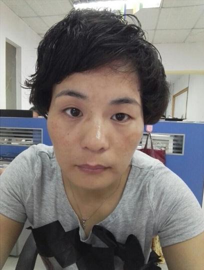 皮肤暗黄有斑点用什么祛斑产品除,天生有斑点祛斑最有效的方法