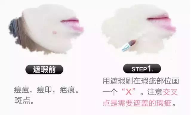 不用整容使鼻子变高挺,鼻子变高整容