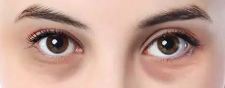 40岁眼周适合用什么样的眼霜,眼周发黑适合用什么眼霜