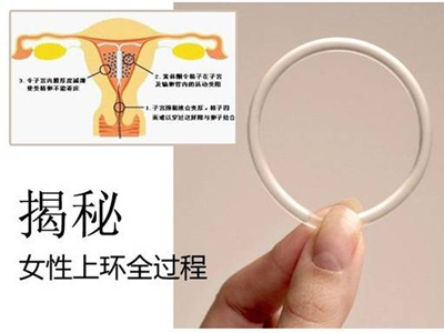 生过孩子后上环,生完小孩上环后要注意哪些