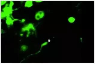 新生儿大脑活动或可破解帕金森、癫痫等医学难题