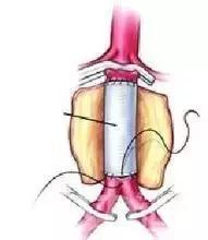 有一种病英文名,有一种病