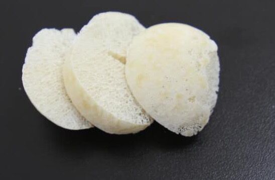 固定骨头的钉子为何无需取出来,身体里的钉子需要取出来吗