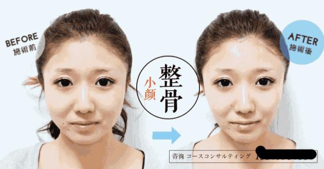 国字脸怎么瘦脸教你变成巴掌小脸,脸小有什么办法