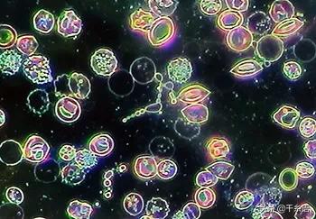 腹泻为什么要做血常规检查