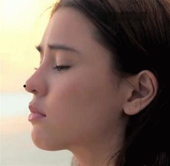 凹面型侧脸怎么改善,凹面型侧脸是怎么造成的