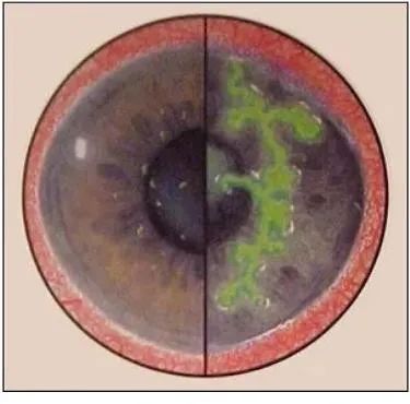 猫眼睛溃疡最佳治疗方法,猫眼睛溃疡用什么眼药水