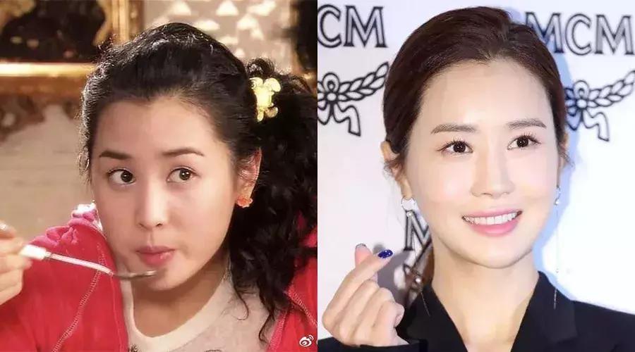 刘梓晨到底有没有整容啊,还记得整容界网红刘梓晨吗