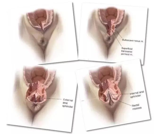 难以想象！重度撕裂，大便*禁失**12余年，只因一场分娩