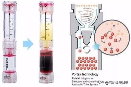 膝盖反复肿是怎么回事,膝盖滑膜炎肿了应该如何按摩