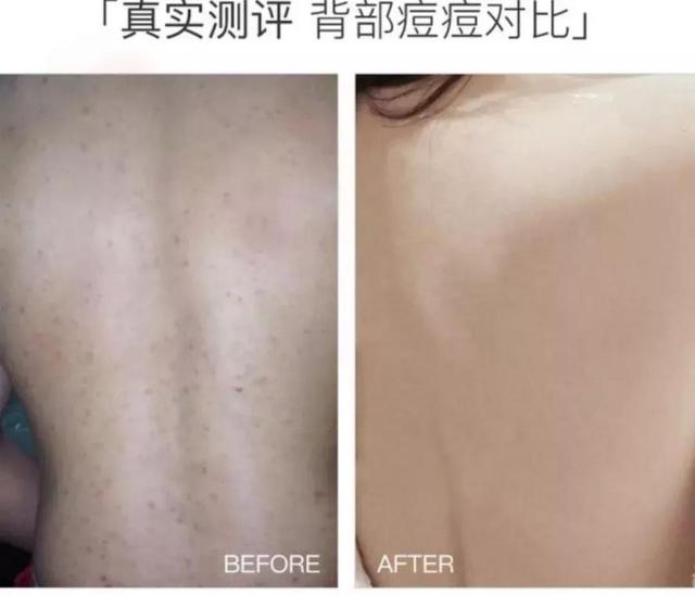 别光顾着脸白，身体皮肤也别落下。羊奶沐浴露让你肌肤嫩又白